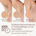 Philips Electric Ipl Hair Remover Philips Bri946/00     *